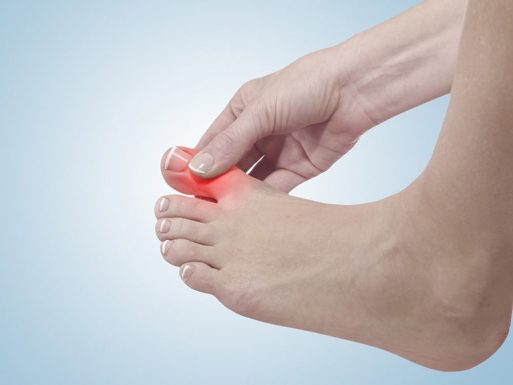 bệnh gout tái phát