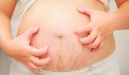 Các thông tin cần biết về bệnh viêm da cơ địa ở phụ nữ mang thai
