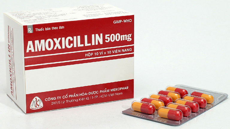 Viêm lợi chân răng - nên uống thuốc Amoxicillin