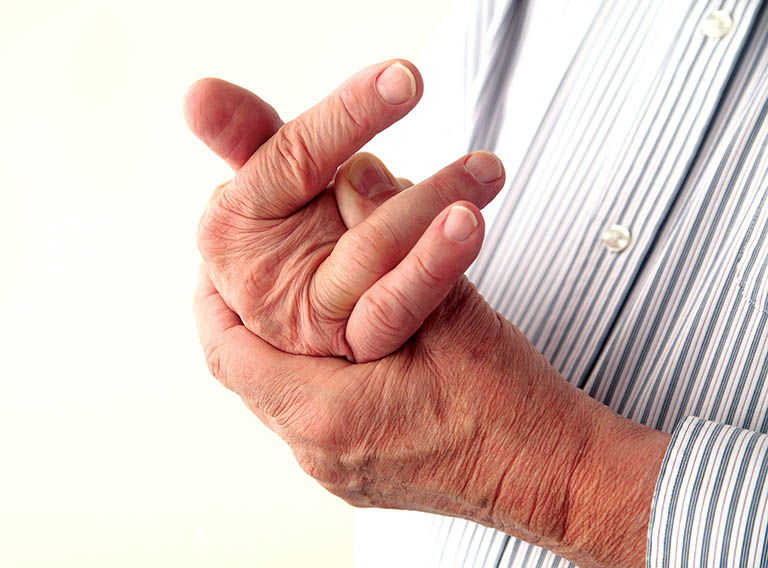 Các khớp bị sưng đau là một trong những triệu chứng bệnh viêm khớp vẩy nến