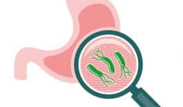 Mối liên hệ giữa bệnh viêm loét dạ dày tá tràng và vi khuẩn Hp
