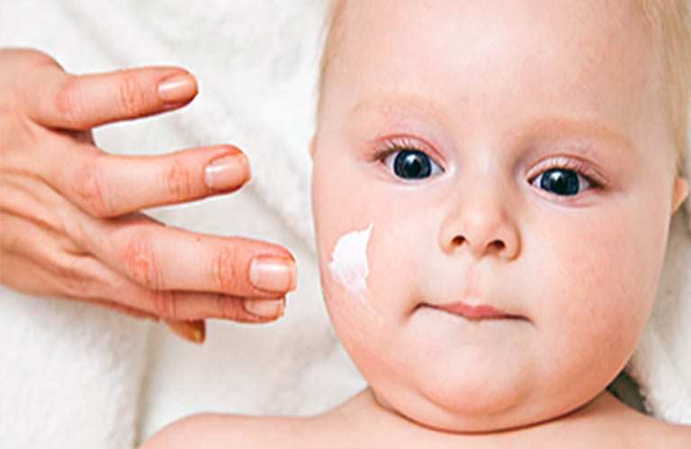 điều trị Eczema cho trẻ nhỏ