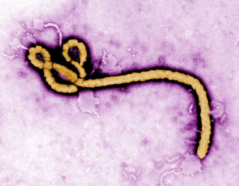 Nhiễm vi khuẩn Ebola cũng có sẽ khiến người bệnh đau bụng và nôn ra máu 