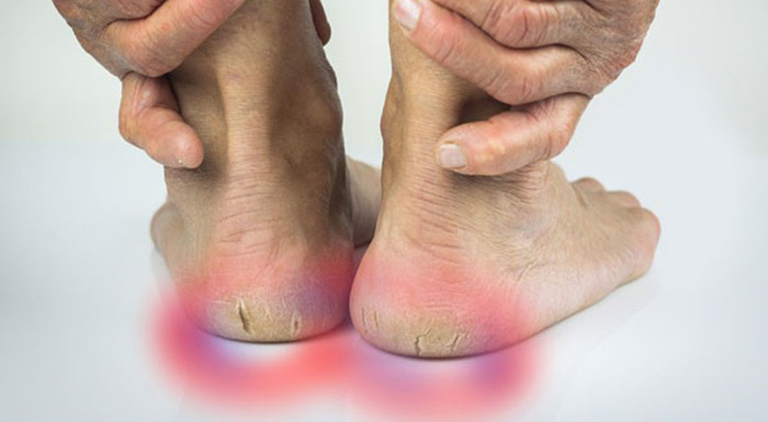 bệnh đau gót chân ở người già