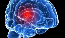 Các nhà nghiên cứu tiết lộ kế hoạch điều trị chứng khối u não nguy hiểm