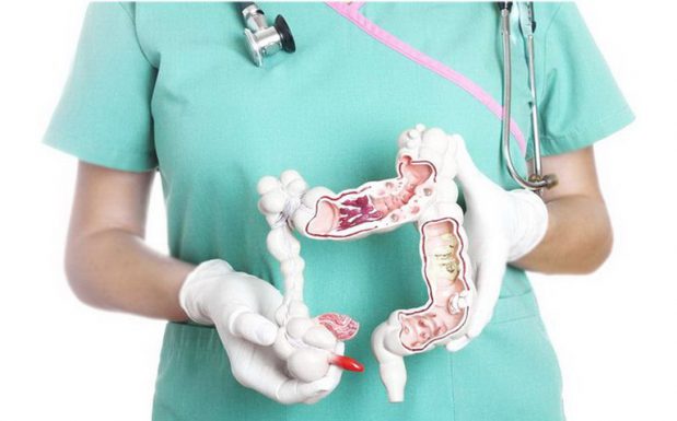 dính ruột sau khi mổ ruột thừa