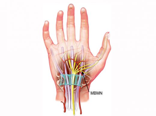 Đau Khớp Ngón Tay: Dấu Hiệu Của Nhiều Căn Bệnh Tiềm ẩn