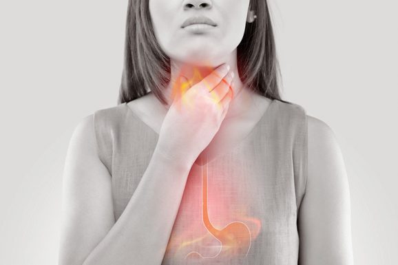 Trào ngược dạ dày nên ăn gì và kiêng gì