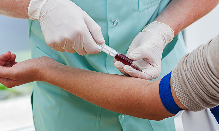 Lấy mẫu máu để các xét nghiệm chức năng thận được thực hiện