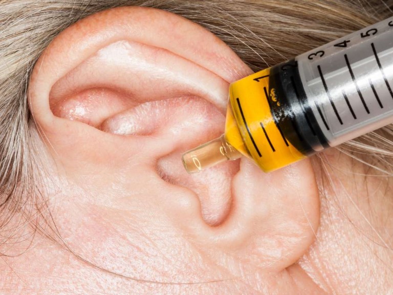 Bệnh viêm tai giữa khi nào cần mổ?