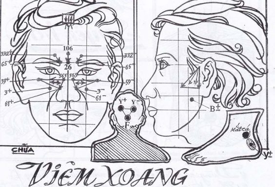 Tìm hiểu cách chữa viêm xoang bằng diện chẩn