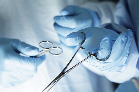 Thông tin về phương pháp phẫu thuật chữa trào ngược dạ dày