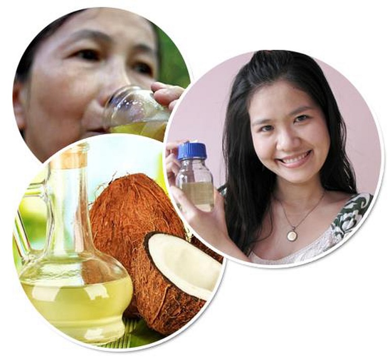 Có nhiều cách để chữa viêm xoang bằng dầu dừa như uống, nhỏ mũi...
