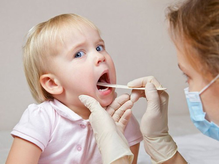 Tìm hiểu bệnh viêm họng cấp ở trẻ em và cách chữa trị 