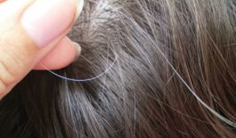 Thận yếu làm tóc bạc sớm và cách điều trị