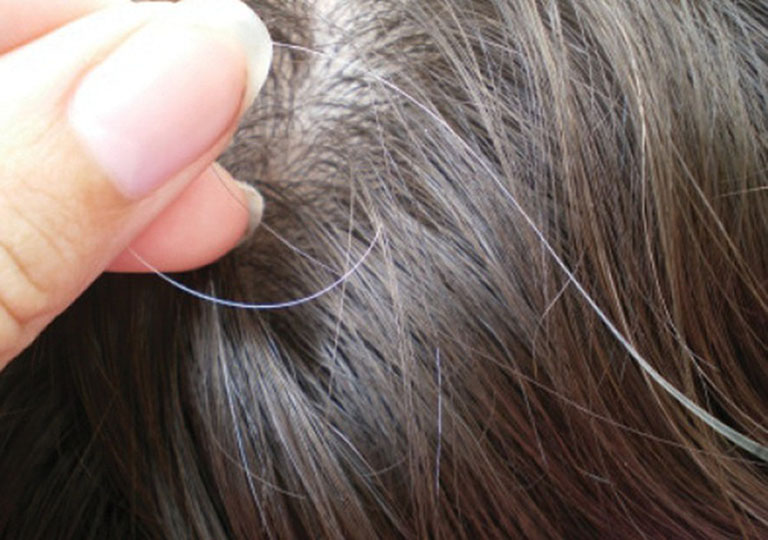 Thận yếu làm tóc bạc sớm và cách điều trị 