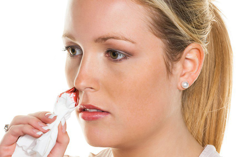 Dịch mũi có lẫn máu cảnh báo bệnh gì?