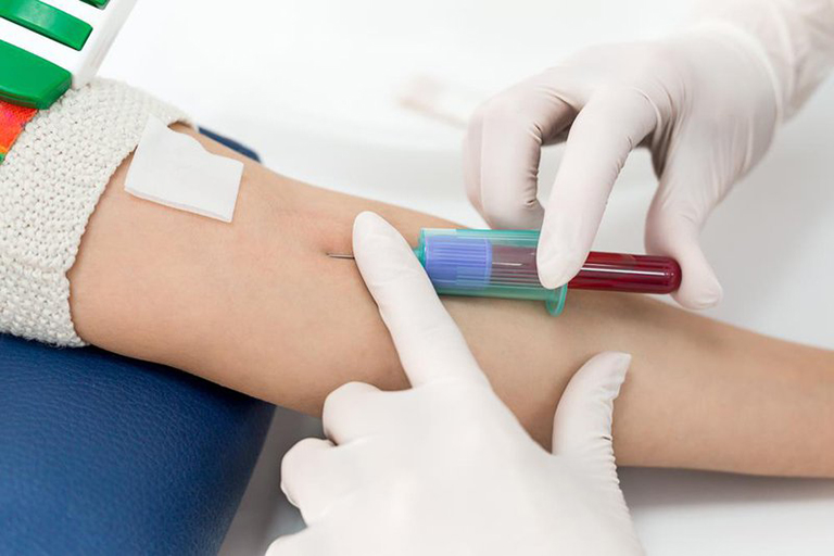 Thường xuyên xét nghiệm máu để theo dõi mức độ bệnh lý trong quá trình sử dụng thuốc Nelfinavir