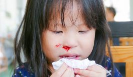 Trẻ bị chảy máu cam thường xuyên là dấu hiệu của bệnh gì?