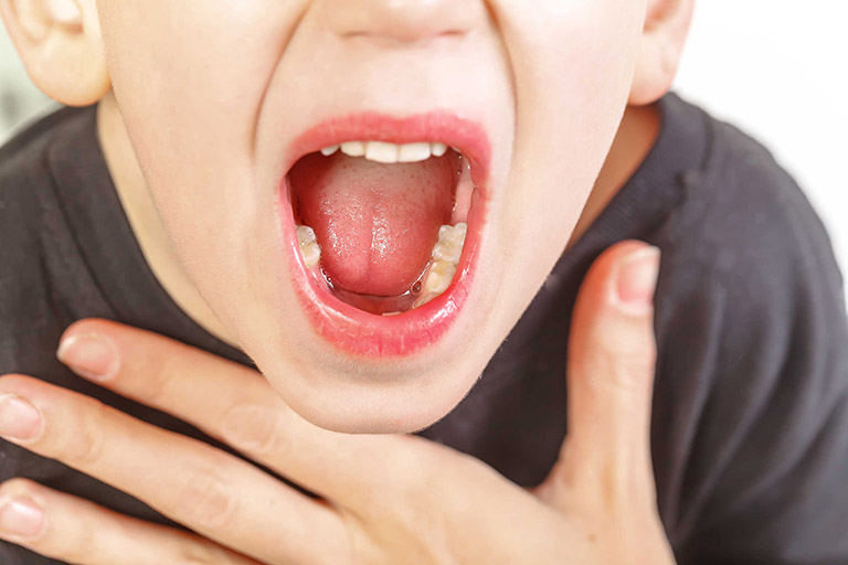 Ung thư vòm họng có thể gây chảy máu cam thường xuyên 