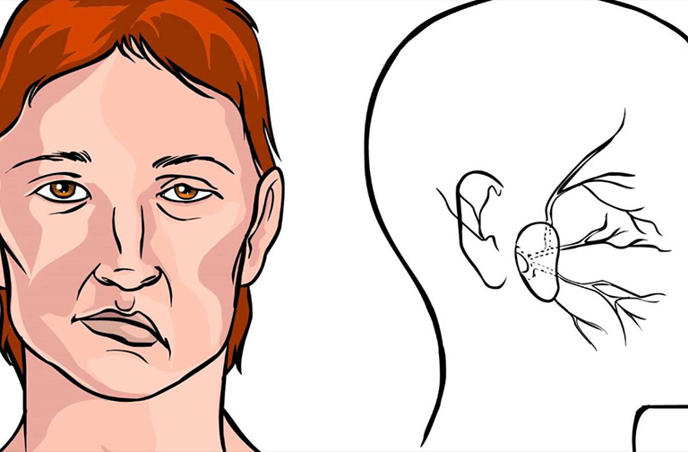 Bệnh viêm họng giả mạc có nguy hiểm không?