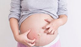 Vì sao bị ngứa khi mang thai? Cách điều trị như thế nào?