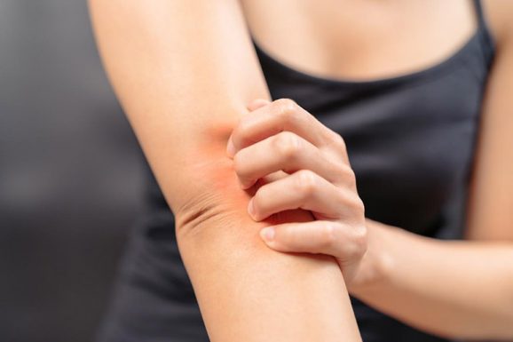 Bệnh lang ben và hắc lào khác nhau như thế nào?