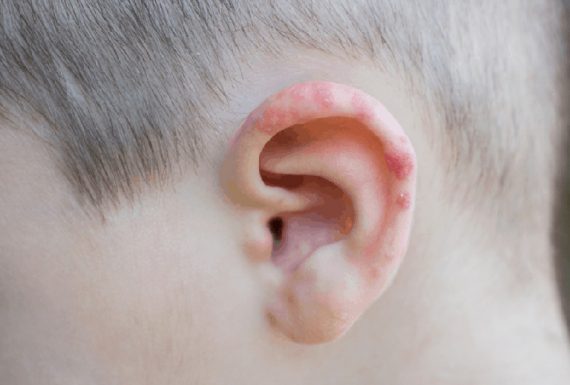 zona thần kinh ở tai