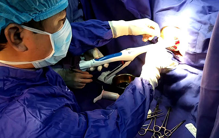 Tiến hành phẫu thuật cắt trĩ đối với trường hợp nặng