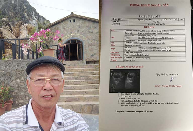 Bác Nguyễn Quang Xây phát hiện bệnh phì đại tiền liệt tuyến sau khi khám sức khoẻ