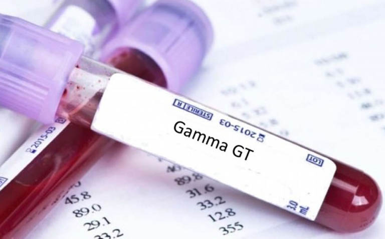 Chỉ số GGT trong máu là gì? Nguy cơ & cách xét nghiệm