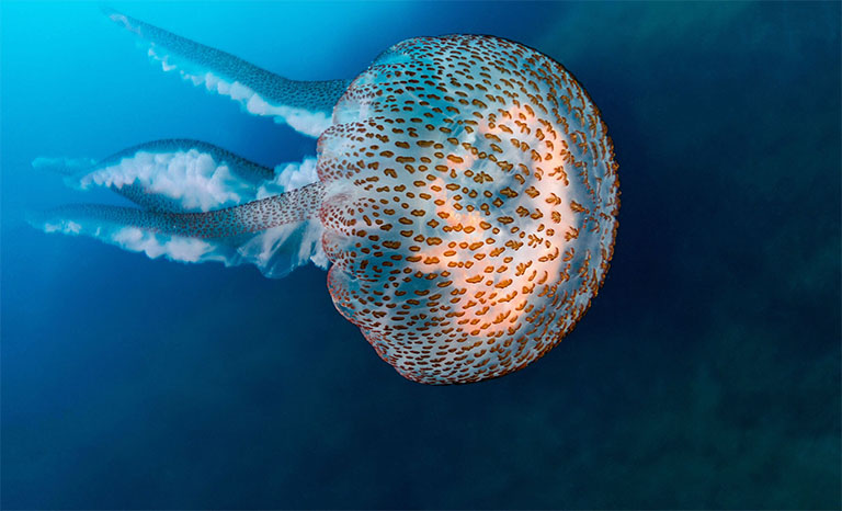 dị ứng sứa biển