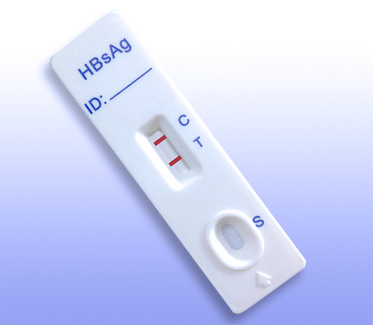 phương pháp xét nghiệm viêm gan B