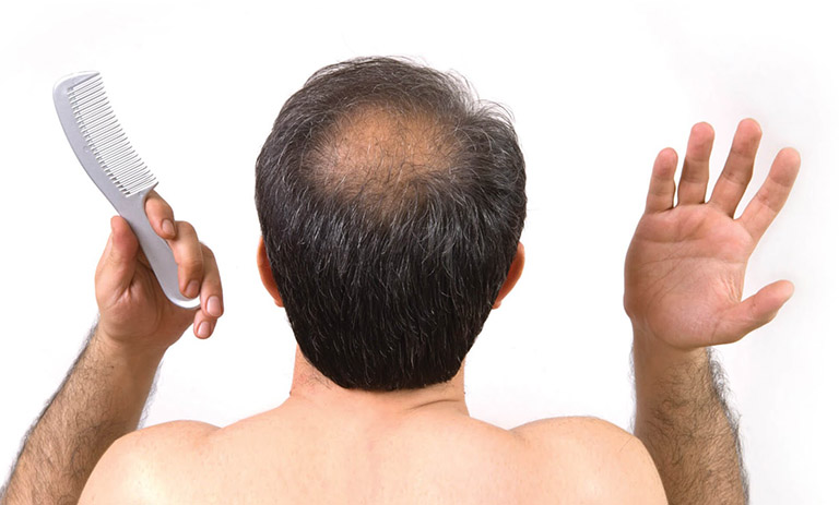 6 dầu gội ngăn rụng tóc hiệu quả dành riêng cho nam