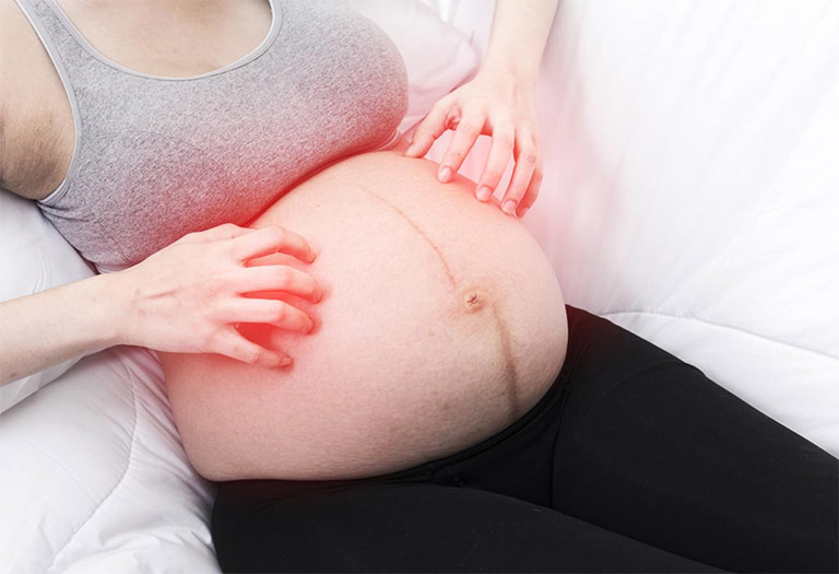 Phụ nữ mang thai bị ngứa trong những tháng cuối có làm ảnh hưởng đến thai nhi không? Cần khắc phục như thế nào?