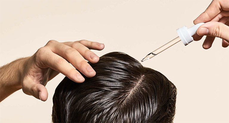 TOP 7 thuốc kích thích mọc tóc nhanh chóng dành cho nam giới  Công Ty Cổ  Phần Sao Thái Dương