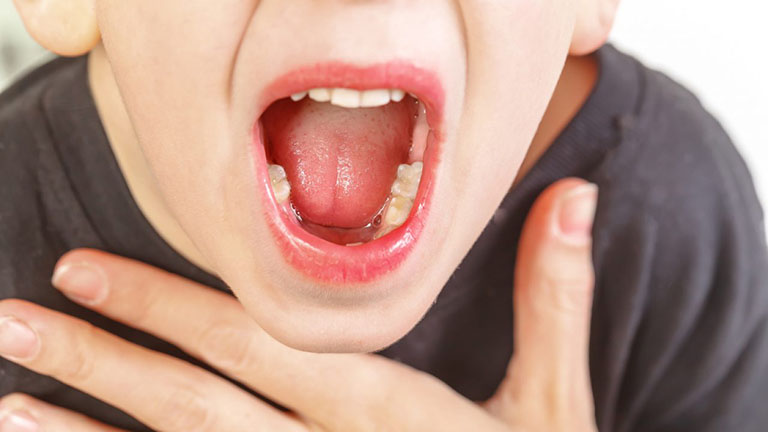 Viêm họng hạt ở lưỡi nguy hiểm như thế nào?