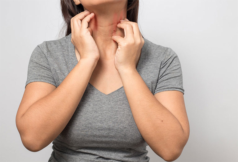Phát ban da hay ngứa ngáy là tác dụng phụ thường gặp nếu dùng quá liều lượng hay cơ thể mẫn cảm với một số thành phần trong sản phẩm