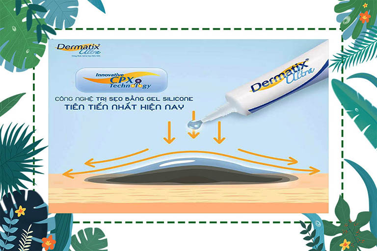 Dermatix Ultra là một sản phẩm hỗ trợ điều trị các loại sẹo đã được chứng minh lâm sàng dựa trên phác đồ xử lý sẹo