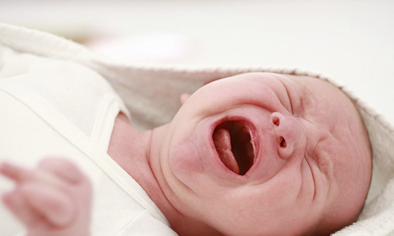 Trẻ sơ sinh bú mẹ bị táo bón có những triệu chứng gì?