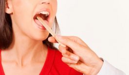 Bệnh ung thư lưỡi có lây hay di truyền không?