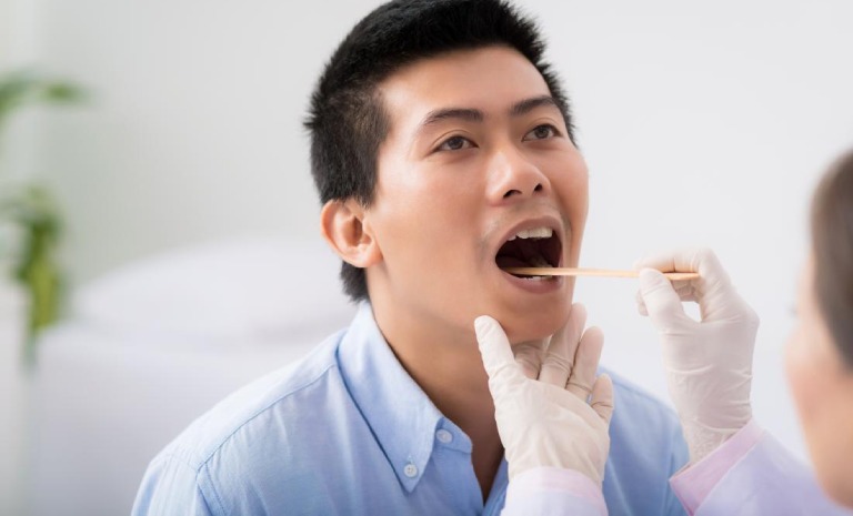 Nhận biết ung thư lưỡi giai đoạn 2