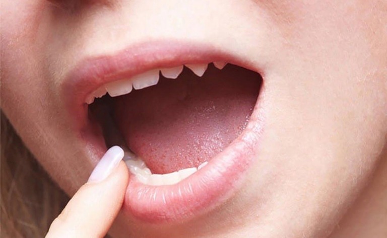 Ung thư lưỡi giai đoạn 2 có chữa được không?
