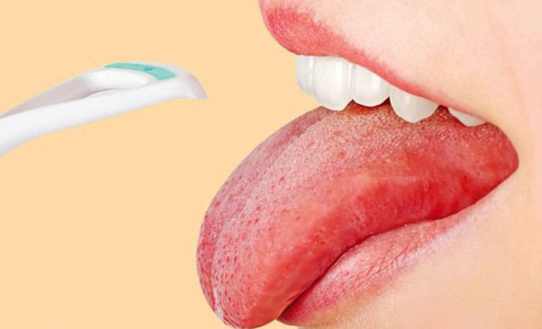 Bệnh ung thư lưỡi sống được bao lâu?