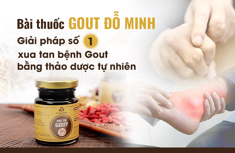 Gout Đỗ Minh giúp kiểm soát bệnh Gout hiệu quả từ gốc