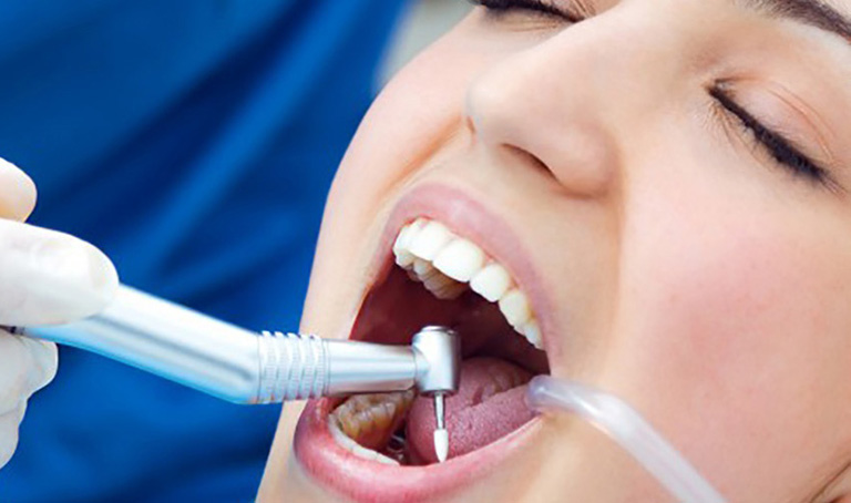 Cách điều trị và xử lý cơn đau áp xe răng