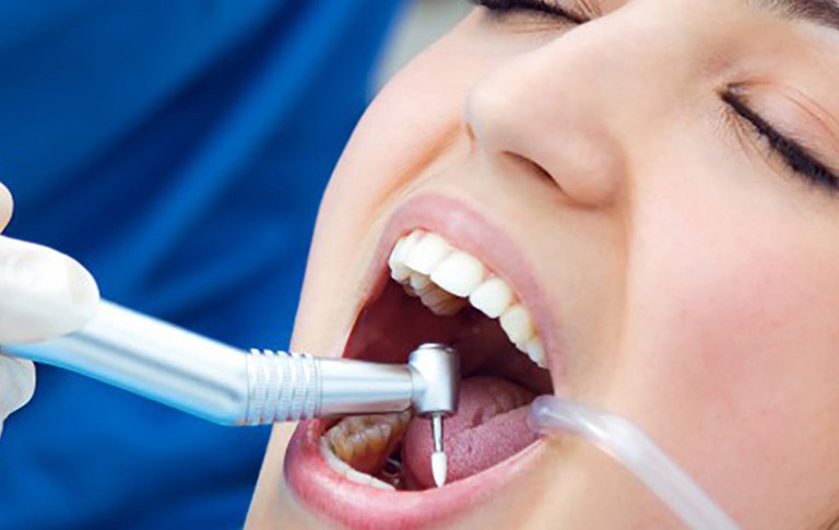Các phương pháp điều trị áp xe răng
