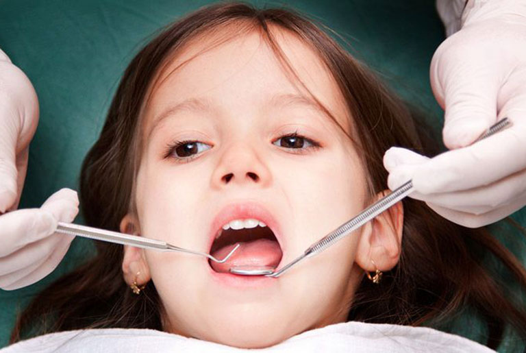 Dấu hiệu nhận biết trẻ bị áp xe răng sữa