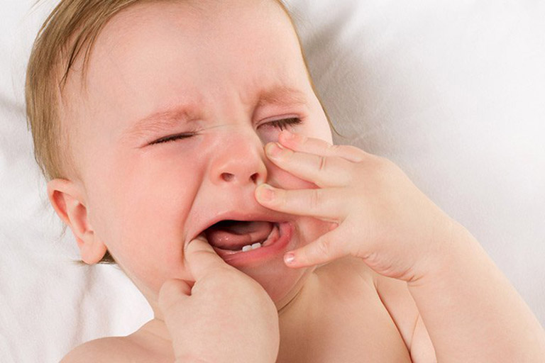 Bé bị viêm loét miệng họng sốt cao là gì? Triệu chứng