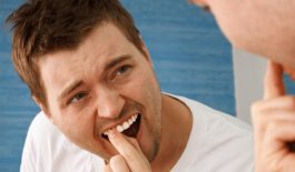 Viêm nha chu làm răng lung lay là gì?